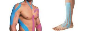 Kineziotaping